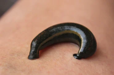 leech-therapy-treatment-entomology-macro-leech-leech-leech-leech-leech-1055446.jpg
